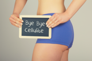 Cellulite is a skin condition that affects both men and women.